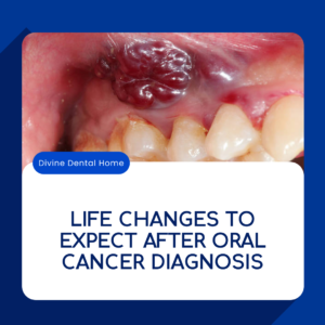 Life Changes to Expect After Oral Cancer Diagnosis